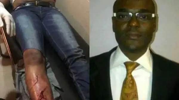 Photos : Zenith Bank Sacks Senior Staff Member Who Allegedly Battered His Wife and Broke Her Leg